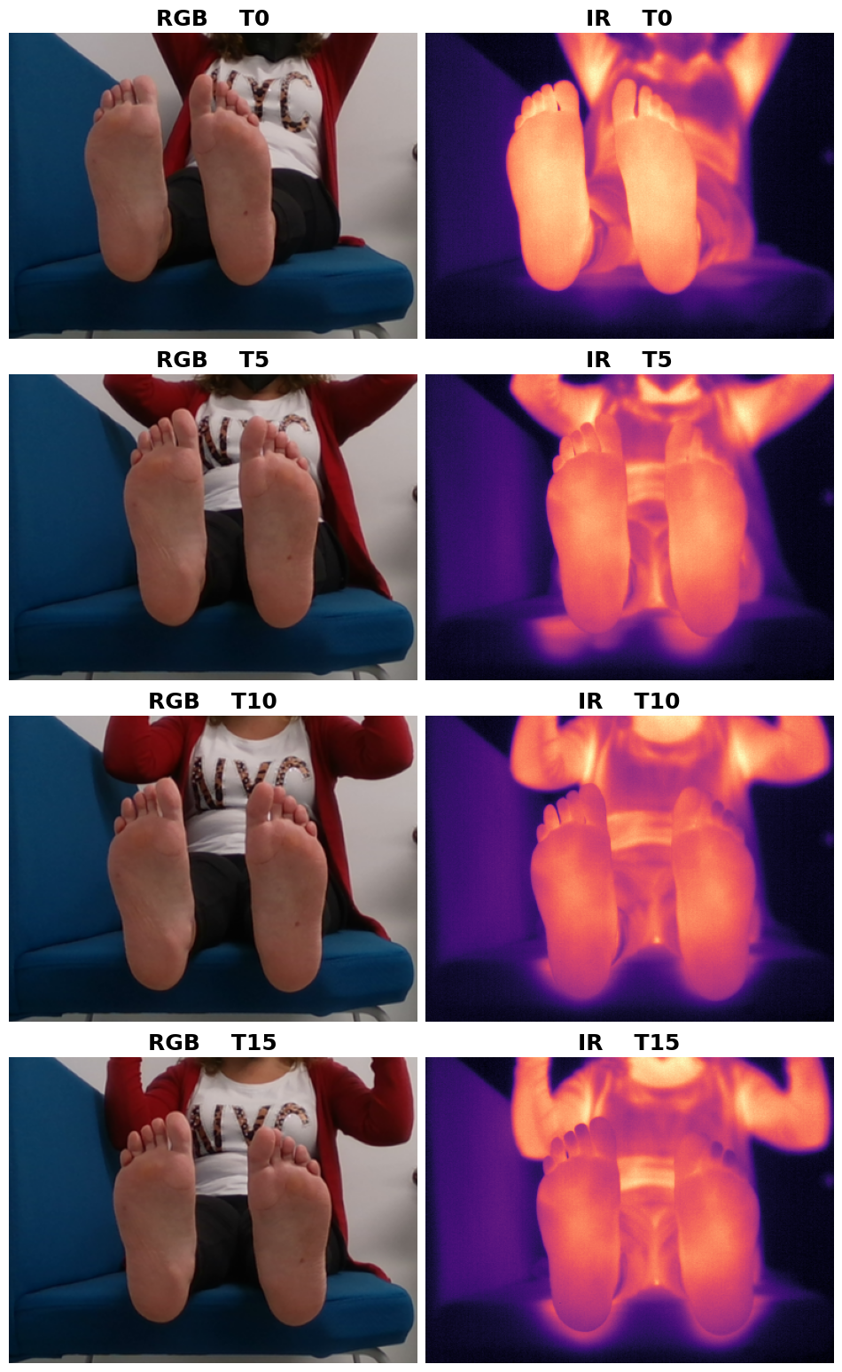 Una persona muestra los pies ante la cámara que muestra simultáneamente las imágenes en visible e infrarrojo