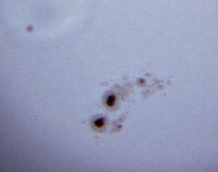 Manchas Solares